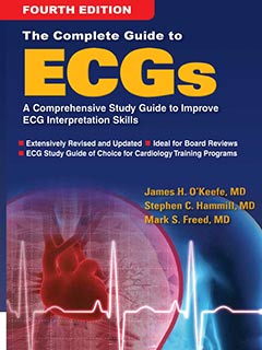 The Complete Guide to ECG - 2017