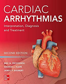 Cardiac Arrhythmias-Interpretation, Diagnosis and Treatment - 2nd Edition