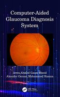 Computer-Aided Glaucoma Diagnosis System – 2020
