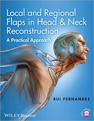 Local and Regional Flaps in Head and Neck Reconstruction - A Practical Approach