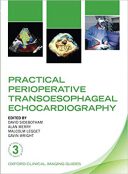 Practical Perioperative Transoesophageal Echocardiography – 2019
