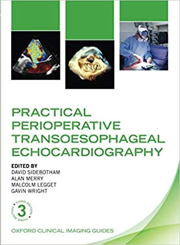 Practical Perioperative Transoesophageal Echocardiography - 2019 - خرید کتاب افست اکوکاردیوگرافی از نشر اشراقیه