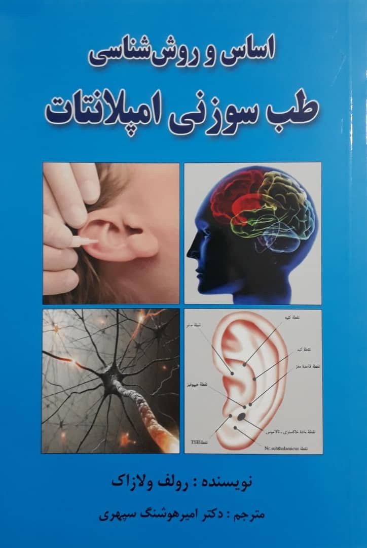 کتاب طب سوزنی امپلانت نشر اشراقیه خرید کتاب امیر هوشنگ سپهری