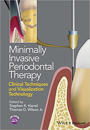 Minimally Invasive Periodontal Therapy - کتاب افست جراحی پریودنتولوزی کم تهاجم - نشر اشراقیه