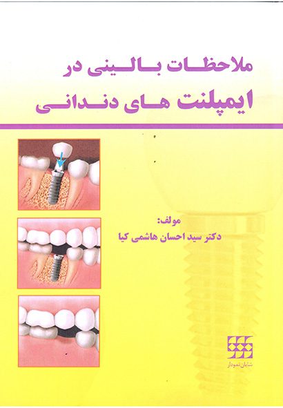 کتاب ملاحظات بالینی در ایمپلنت های دندانی
