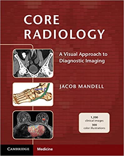 Core Radiology A Visual Approach to Diagnostic Imaging | 2014