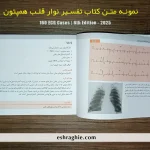 نمونه متن کتاب تفسیر ۱۶۰ نوار قلب (ECG Cases 2025) | ویرایش ششم