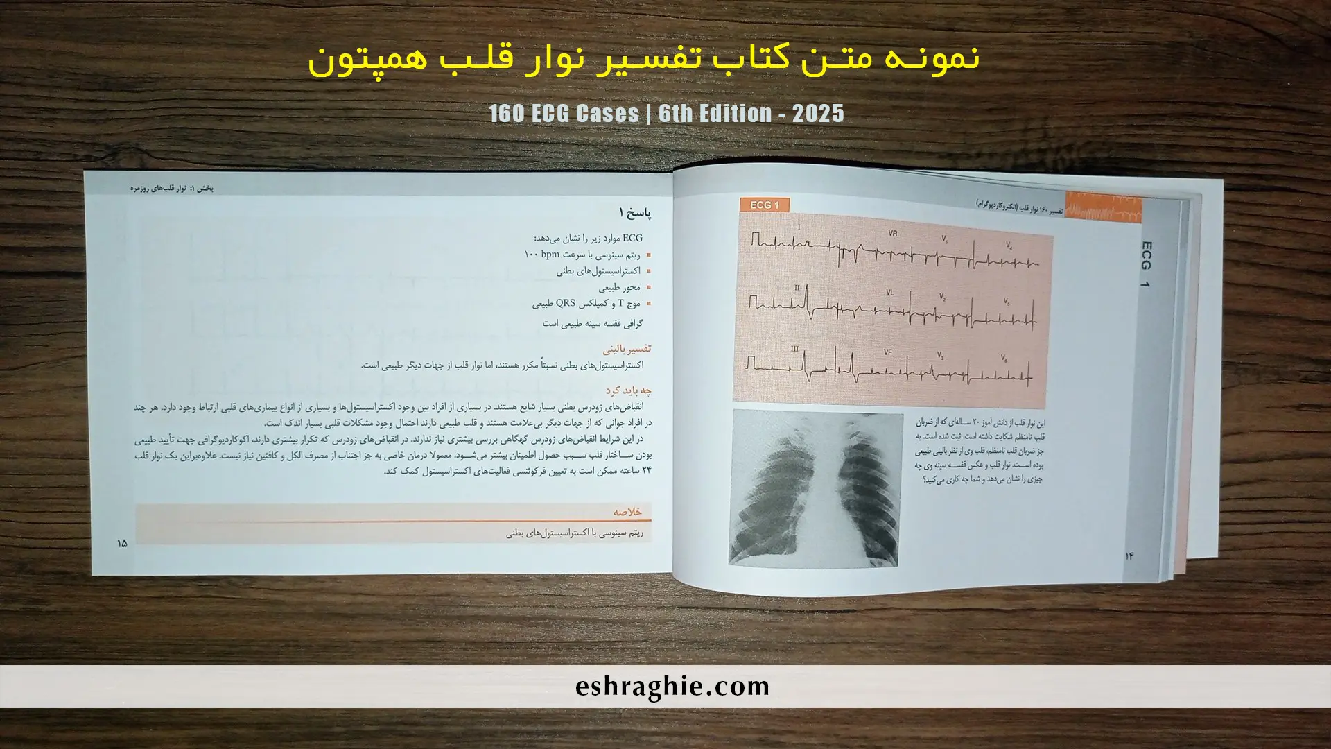 نمونه متن کتاب تفسیر ۱۶۰ نوار قلب (ECG Cases 2025) | ویرایش ششم