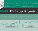 تفسیر ۱۵۰ نوار ECG | ویرایش پنجم – ۲۰۱۹