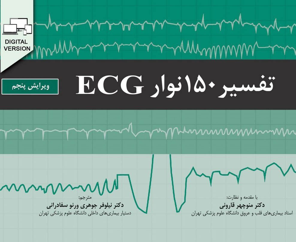 تفسیر 150 نوار ECG | ویرایش پنجم - 2019