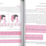 نمونه ترجمه تنها کتاب EKG در هفت روز - 3