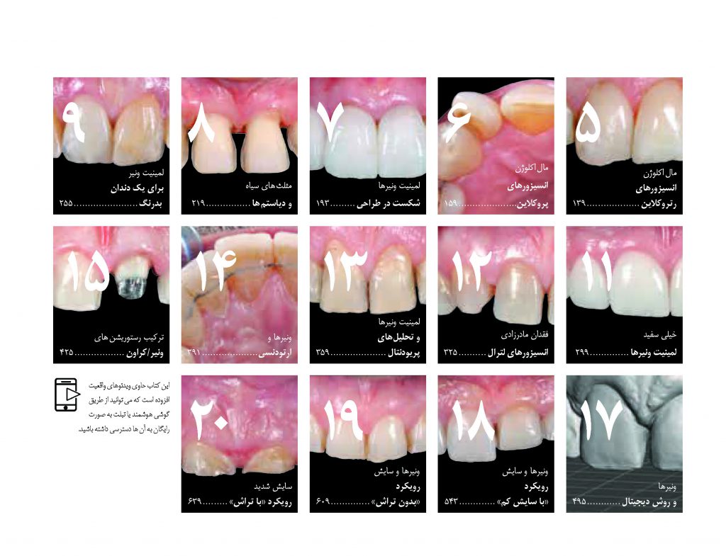 دندانپزشکی زیبایی - کتاب لمینت و ونیر