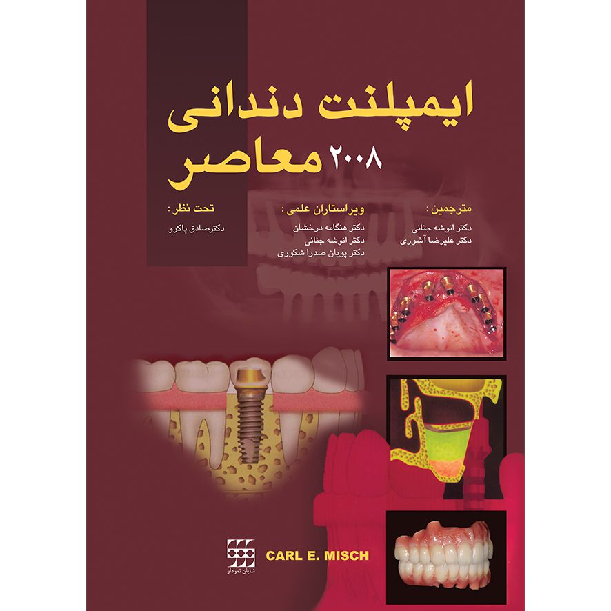 کتاب ایمپلنت های دندانی معاصر کارل میش 2008 - دو جلدی