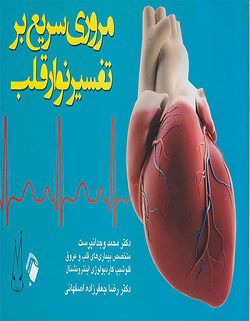 مروری سریع بر تفسیر نوار قلب