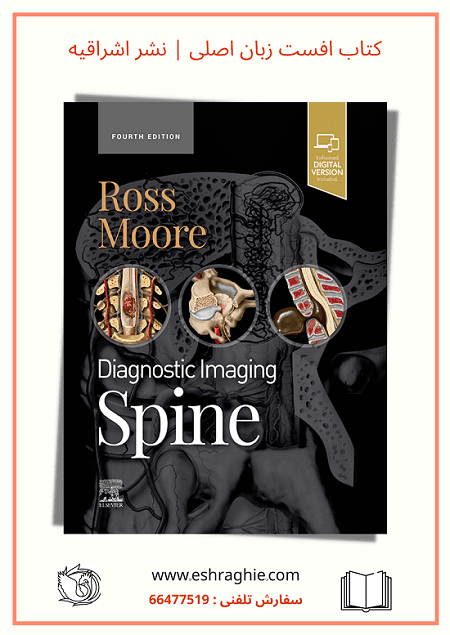 Ross Moore - Diagnostic Imaging : Spine 4th Edition | 2021