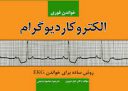 خواندن فوری الکتروکاردیوگرام | روش ساده برای خواندن EKG