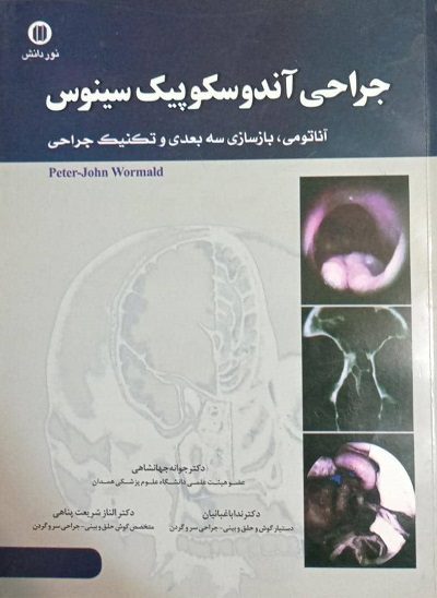 کتاب جراحی آندوسکوپیک سینوس | آناتومی , بازسازی سه بعدی و تکنیک جراحی