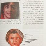 نمونه داخل کتاب جراحی زیبایی پلک | تالیف دکتر ترجمی