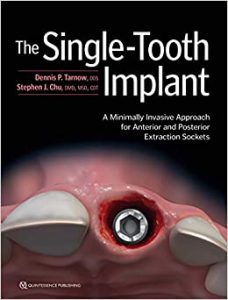 Single Implant tooth