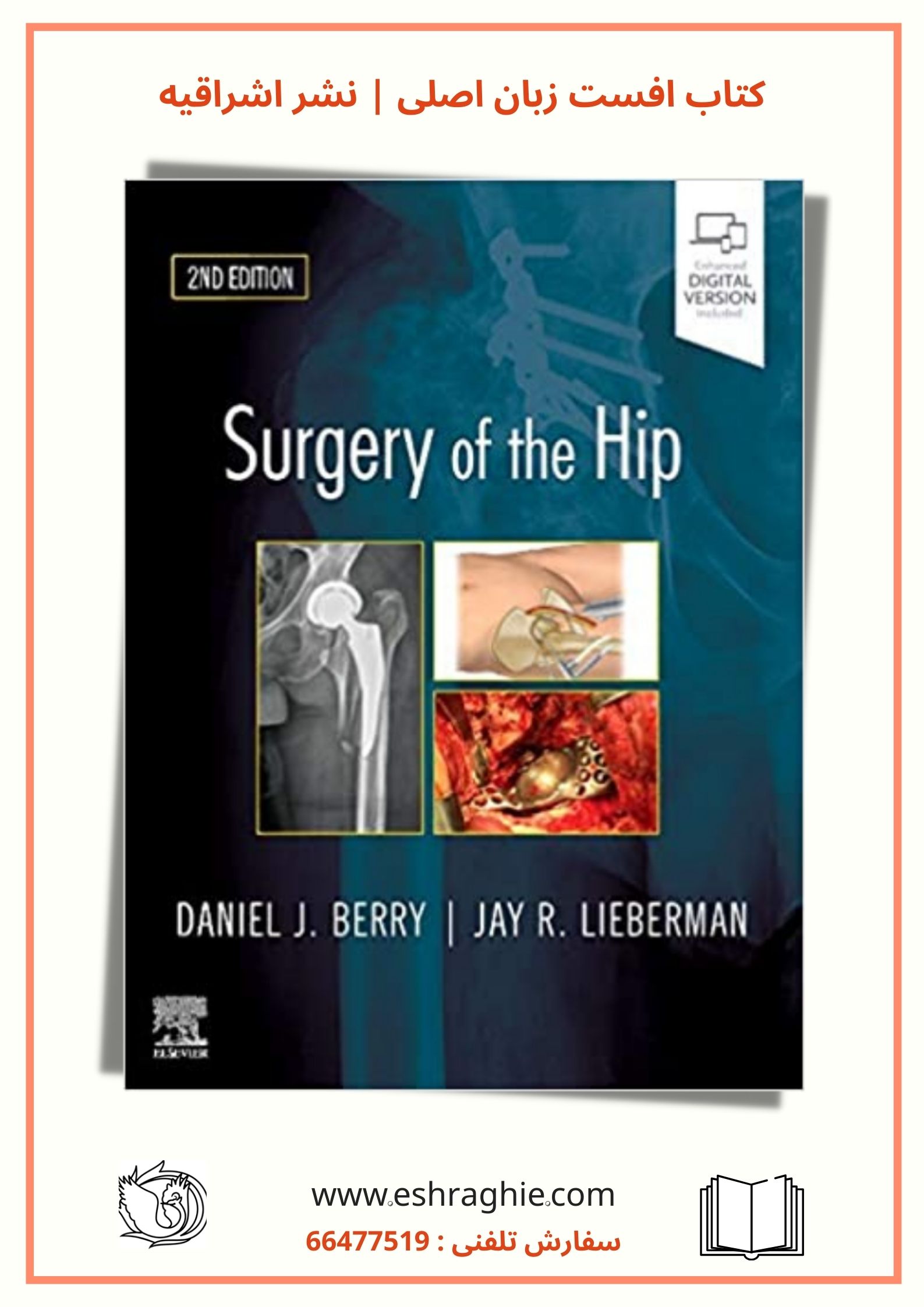 Surgery of the Hip - Berry | 2019