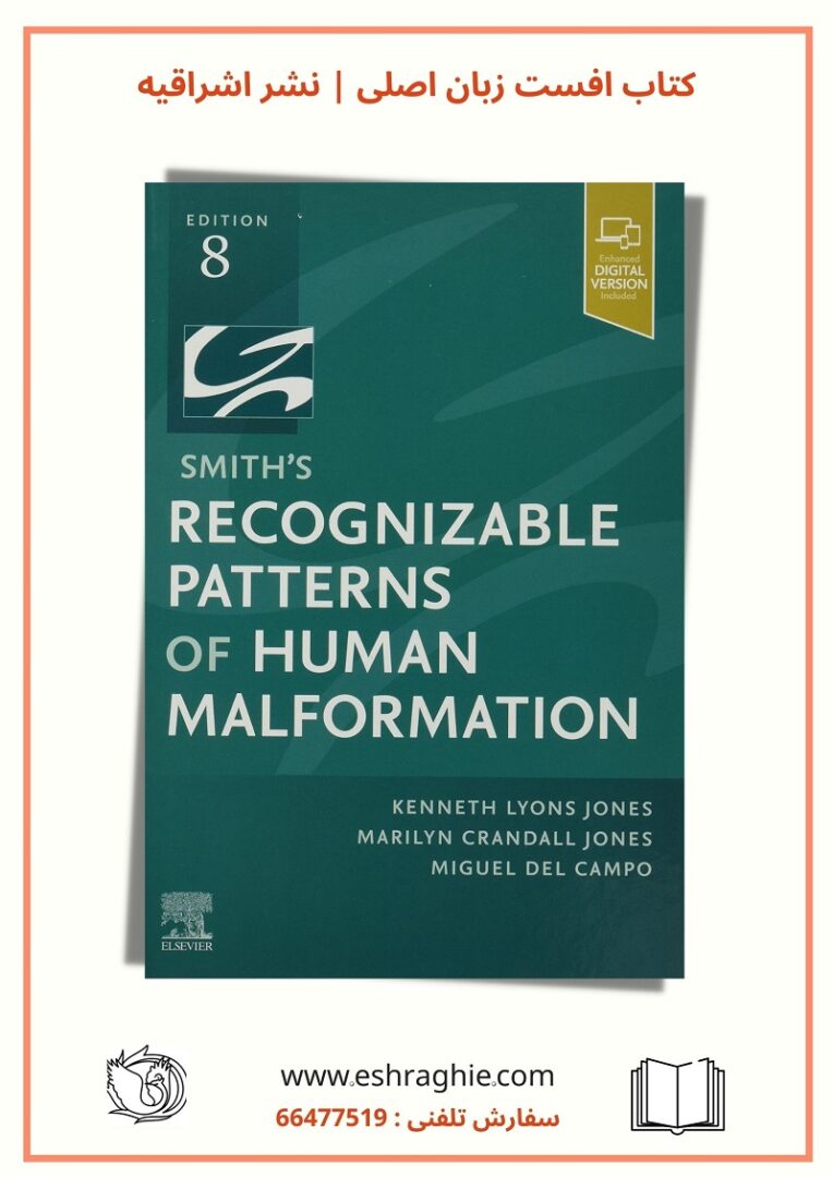 Smith's Recognizable Patterns of Human Malformation | 2021