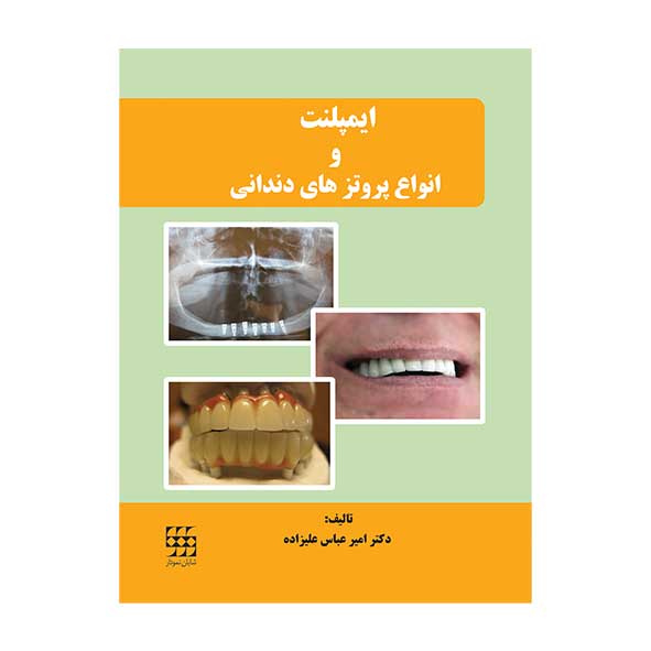 کتاب ایمپلنت و انواع پروتزهای دندانی