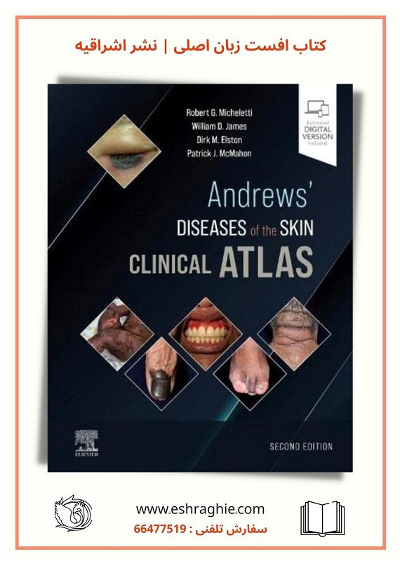 Andrews' Diseases of the Skin Clinical Atlas 2nd Edition | 2022