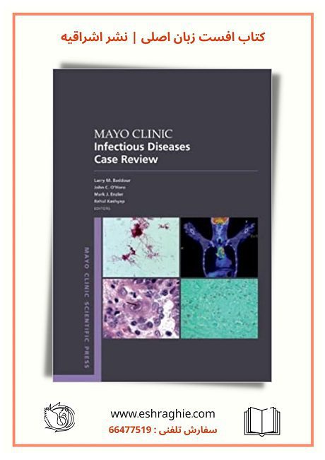 Mayo Clinic Infectious Disease Case Review 2022 With Board-Style Questions and Answers