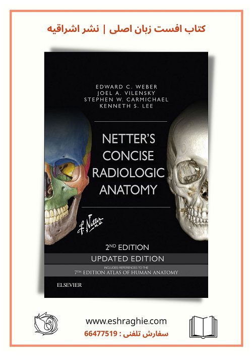 Netter's Concise Radiologic Anatomy Updated Edition | 2nd Edition