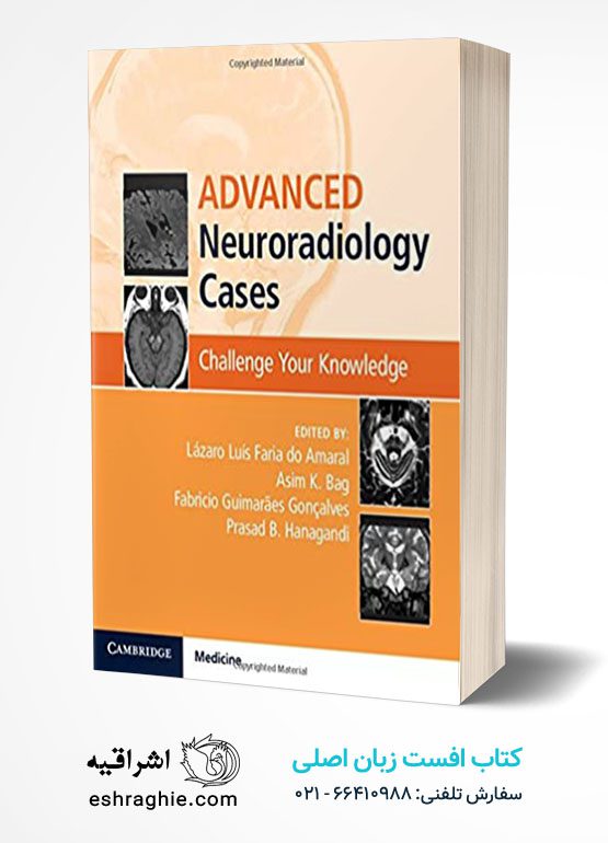 Advanced Neuroradiology Cases: Challenge Your Knowledge