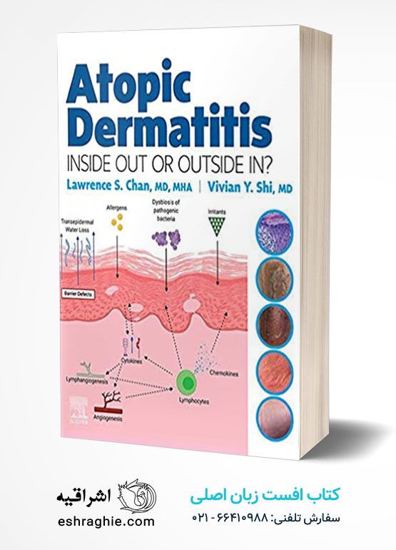 Atopic Dermatitis: Inside Out or Outside In