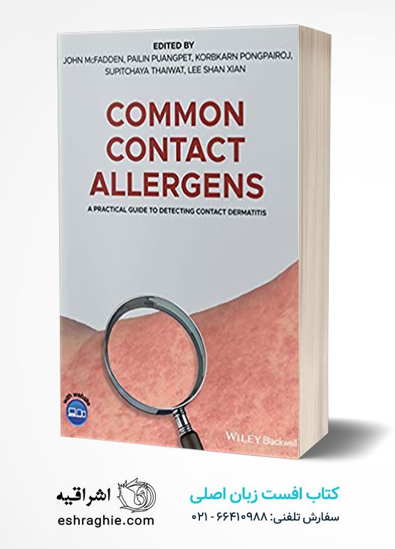 Common Contact Allergens: A Practical Guide to Detecting Contact Dermatitis
