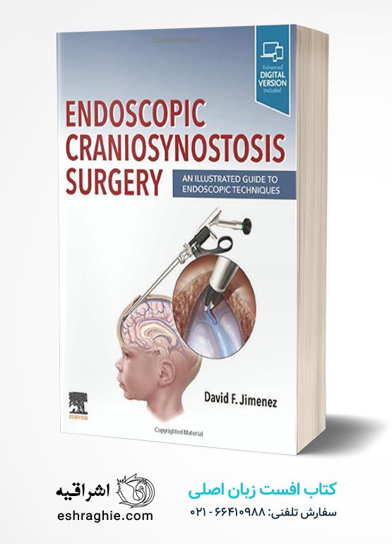 Endoscopic Craniosynostosis Surgery: An Illustrated Guide to Endoscopic Techniques
