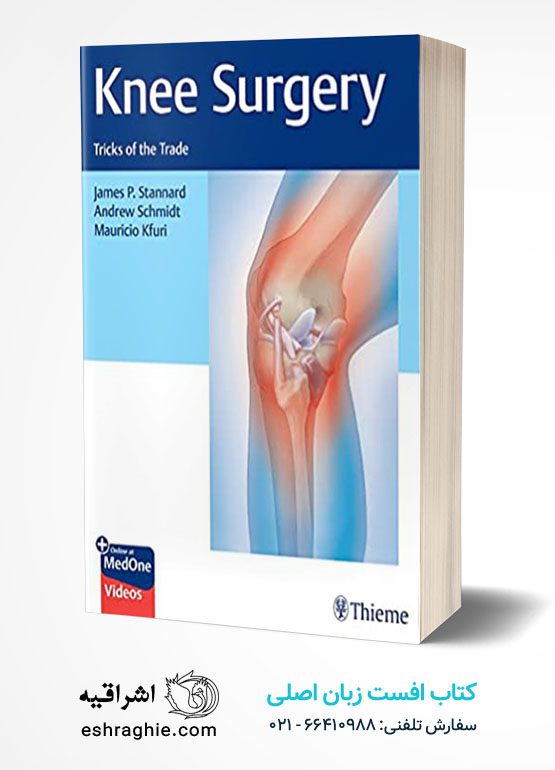 Knee Surgery: Tricks of the Trade