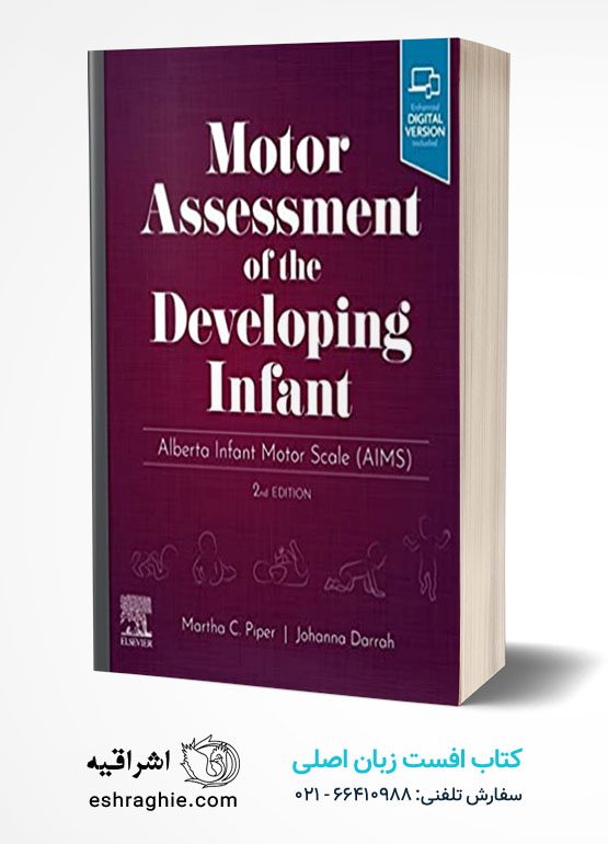 Motor Assessment of the Developing Infant: Alberta Infant Motor Scale