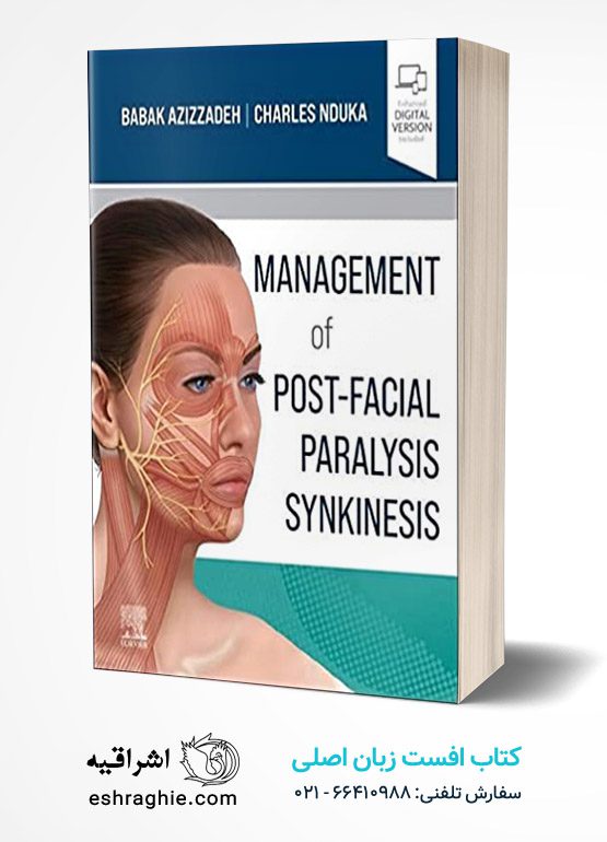 Management of Post-Facial Paralysis Synkinesis 1st Edition