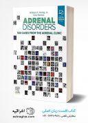 Adrenal Disorders: 100 Cases From The Adrenal Clinic