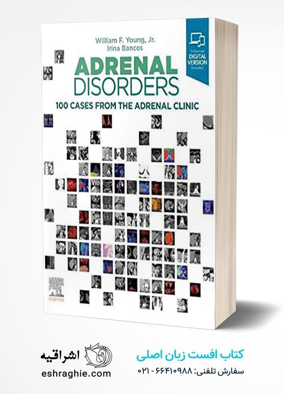 Adrenal Disorders: 100 Cases from the Adrenal Clinic
