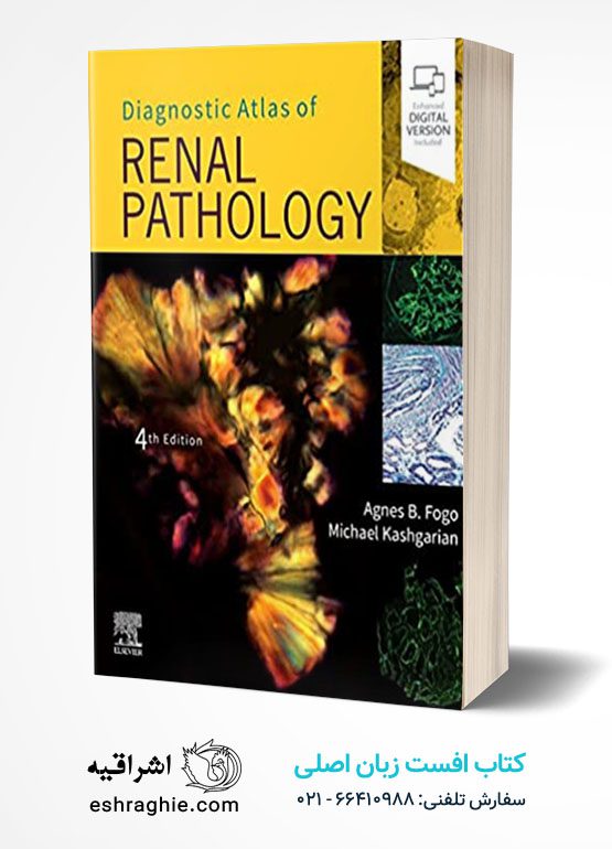 Diagnostic Atlas of Renal Pathology