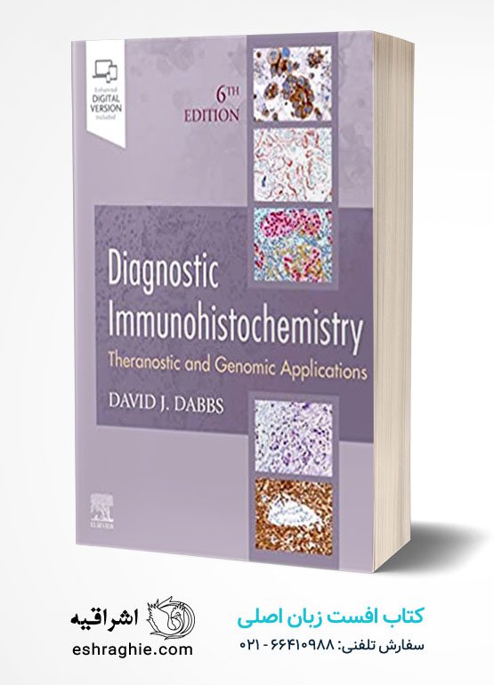 Diagnostic Immunohistochemistry: Theranostic and Genomic Applications