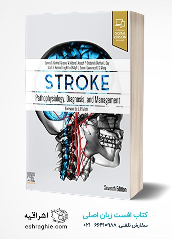 Stroke: Pathophysiology, Diagnosis, and Management