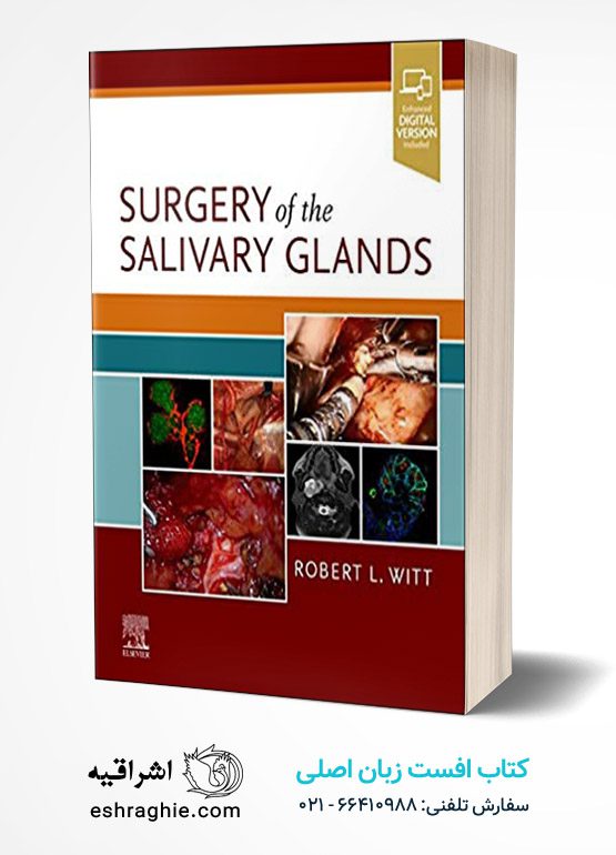 Surgery of the Salivary Glands 1st Edition