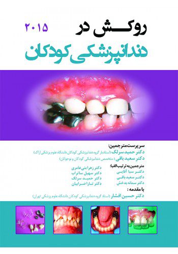 روکش در دندانپزشکی کودکان