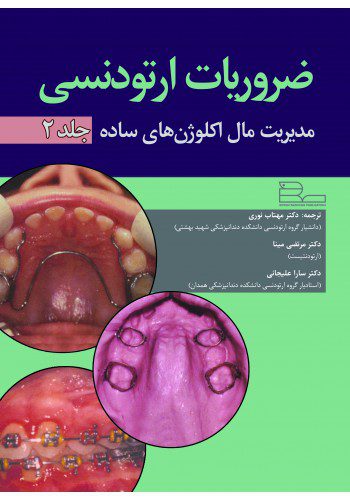 ضروریات ارتودنسی (جلد دوم) - مدیریت مال اکلوژن های ساده