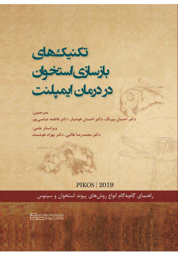 تکنیک های بازسازی استخوان در درمان ایمپلنت