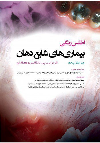 اطلس رنگی بیماری های شایع دهان