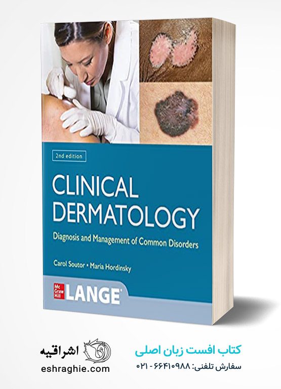 Clinical Dermatology: Diagnosis and Management of Common Disorders