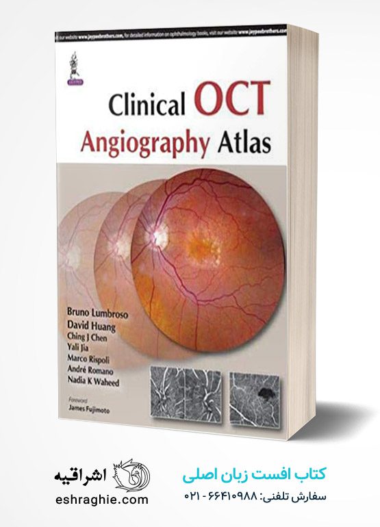 Clinical OCT Angiography Atlas