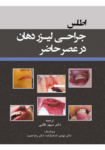 اطلس جراحی لیزر دهان در عصر حاضر