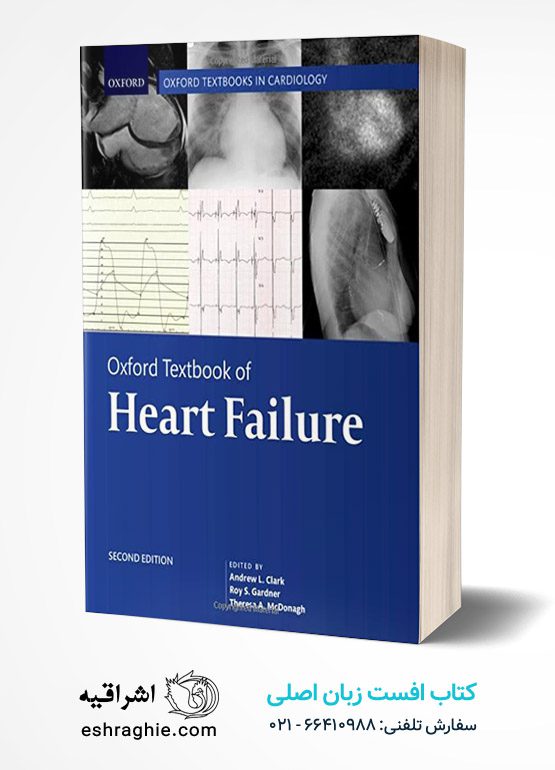 Oxford Textbook of Heart Failure